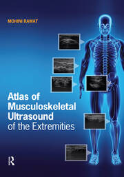 Atlas of Musculoskeletal Ultrasound of the Extremities book cover