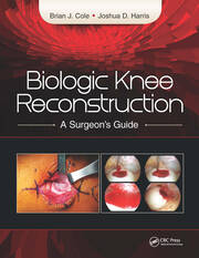 Biologic Knee Reconstruction: A Surgeon's Guide book cover