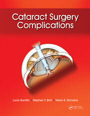 Cataract Surgery Complications book cover