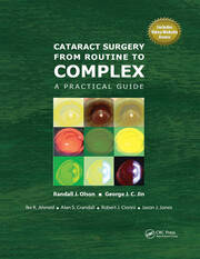 Cataract Surgery from Routine to Complex: A Practical Guide book cover