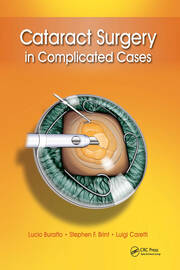 Cataract Surgery in Complicated Cases book cover