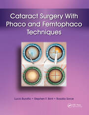 Cataract Surgery With Phaco and Femtophaco Techniques book cover