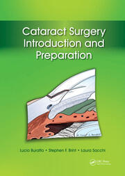 Cataract Surgery: Introduction and Preparation book cover