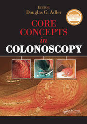 Core Concepts in Colonoscopy book cover