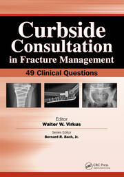 Curbside Consultation in Fracture Management: 49 Clinical Questions book cover