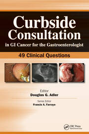 Curbside Consultation in GI Cancer for the Gastroenterologist: 49 Clinical Questions book cover