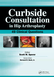 Curbside Consultation in Hip Arthroplasty: 49 Clinical Questions book cover