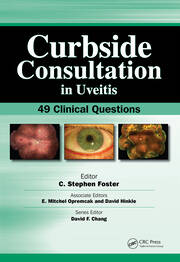 Curbside Consultation in Uveitis: 49 Clinical Questions book cover