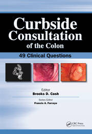 Curbside Consultation of the Colon: 49 Clinical Questions book cover