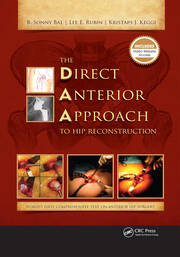 The Direct Anterior Approach to Hip Reconstruction book cover