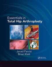 Essentials in Total Hip Arthroplasty book cover