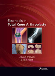 Essentials in Total Knee Arthroplasty book cover