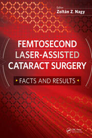 Femtosecond Laser-Assisted Cataract Surgery: Facts and Results book cover