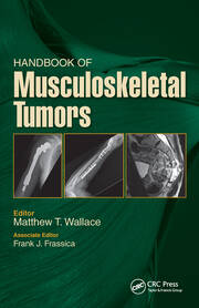 Handbook of Musculoskeletal Tumors book cover