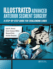 Illustrated Advanced Anterior Segment Surgery: A Step-by-Step Guide for Challenging Cases book cover