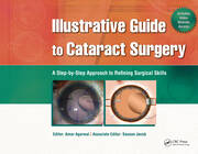 Illustrative Guide to Cataract Surgery: A Step-by-Step Approach to Refining Surgical Skills book cover
