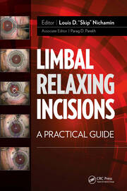 Limbal Relaxing Incisions: A Practical Guide book cover