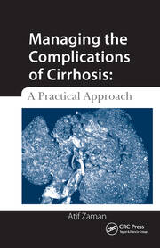 Managing the Complications of Cirrhosis: A Practical Approach book cover