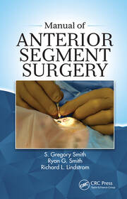 Manual of Anterior Segment Surgery book cover