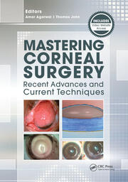 Mastering Corneal Surgery: Recent Advances and Current Techniques book cover