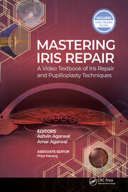Mastering Iris Repair: A Video Textbook of Iris Repair and Pupilloplasty Techniques book cover