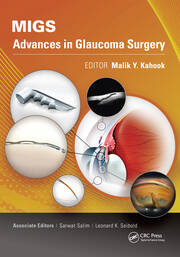 MIGS: Advances in Glaucoma Surgery book cover