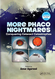 More Phaco Nightmares: Conquering Cataract Catastrophes book cover
