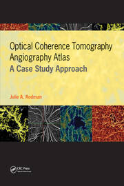 Optical Coherence Tomography Angiography Atlas: A Case Study Approach book cover