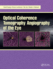 Optical Coherence Tomography Angiography of the Eye: OCT Angiography book cover
