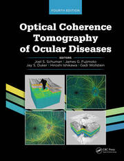 Optical Coherence Tomography of Ocular Diseases book cover