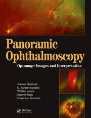 Panoramic Ophthalmoscopy: Optomap Images and Interpretation book cover