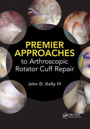 Premier Approaches to Arthroscopic Rotator Cuff Repair book cover