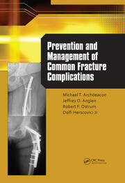 Prevention and Management of Common Fracture Complications book cover