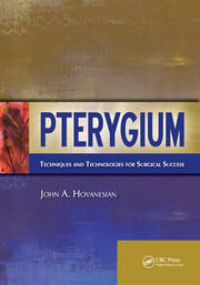 Pterygium: Techniques and Technologies for Surgical Success book cover