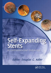 Self-Expanding Stents in Gastrointestinal Endoscopy book cover