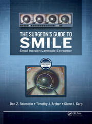 The Surgeon’s Guide to SMILE: Small Incision Lenticule Extraction book cover