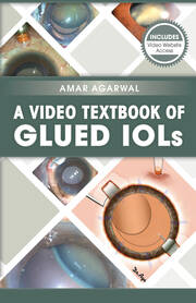A Video Textbook of Glued IOLs book cover