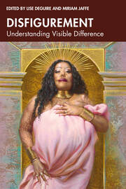 Disfigurement: Understanding Visible Difference book cover