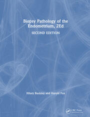 Biopsy Pathology of the Endometrium, 2Ed book cover