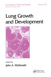 Lung Growth and Development book cover