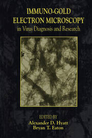 Immuno-Gold Electron Microscopy in Virus Diagnosis and Research book cover