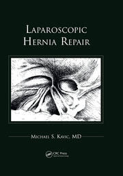 Laparoscopic Hernia Repair book cover