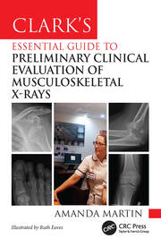 Clark’s Essential Guide to Preliminary Clinical Evaluation of Musculoskeletal X-rays book cover
