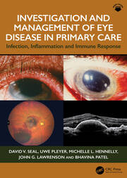 Investigation & Management of Eye Disease in Primary Care: Infection, Inflammation and Immune Response book cover