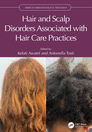 Hair and Scalp Disorders Associated with Hair Care Practices book cover