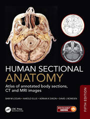 Human Sectional Anatomy: Atlas of annotated body sections, CT and MRI images book cover