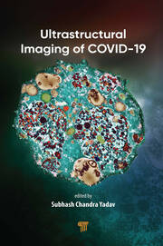 Ultrastructural Imaging of COVID-19 book cover