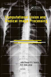 Computational Vision and Medical Image Processing: VipIMAGE 2007 book cover