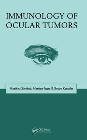 Immunology of Ocular Tumors book cover