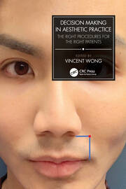 Decision Making in Aesthetic Practice: The Right Procedures for the Right Patients book cover